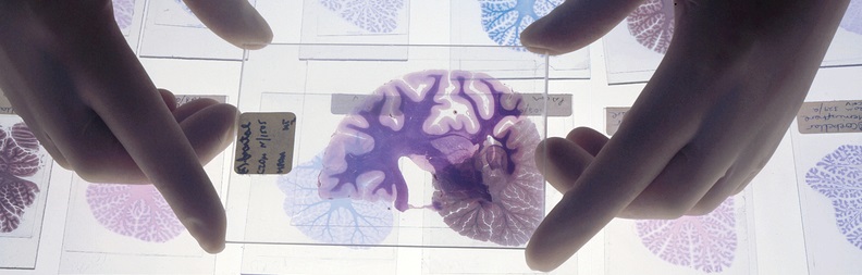 Image of gloved hands sorting brain tissue slides